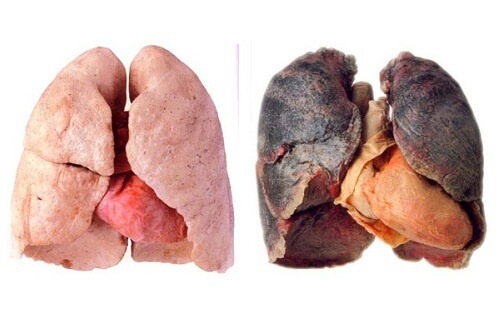 Съвети за по-чисти бели дробове