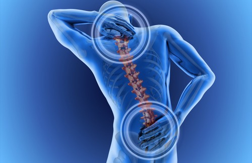 болката в гърба е сред първите симптоми на дискова херния