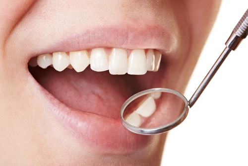 5 начина трайно да отстраним плака от зъбите