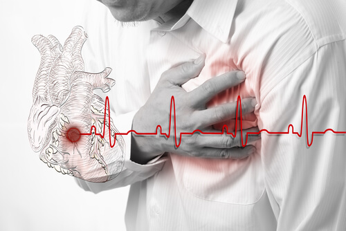 В повечето случаи симптомите на сърдечната атака са лесни за идентифициране.
