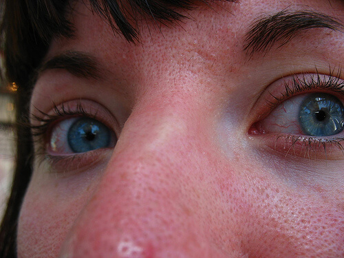 какво представляват черните точки