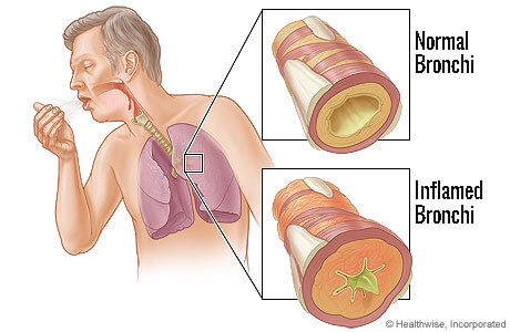 Бронхите имат важна функция за дихателното здраве на човек