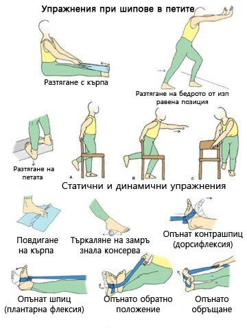 полезни упражнения при шипове в петите
