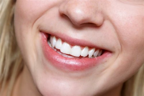 бели зъби с натурални продукти