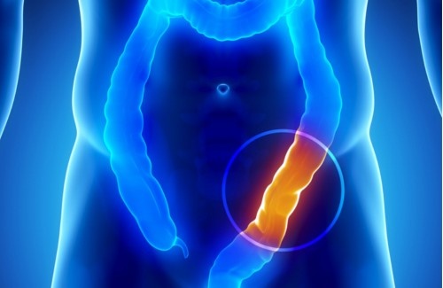 прочистване на дебелото черво