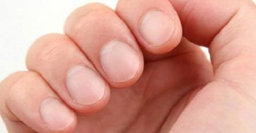 8 предупредителни знака, които нашите нокти дават