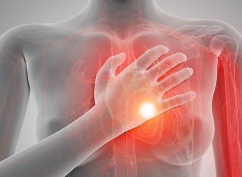 има разлика между спирането на сърдечната дейност и самия сърдечен удар