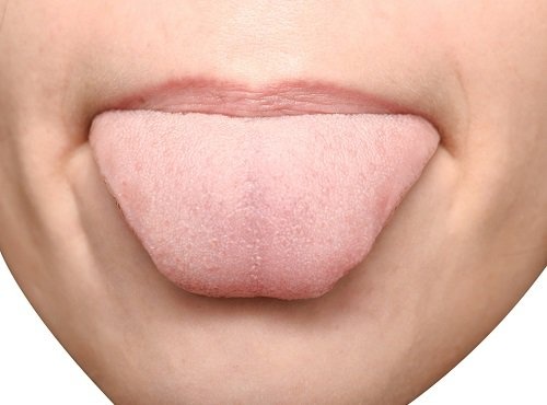 Ако забележите, че езикът ви има бяло покритие, променете навиците си на хранене. 