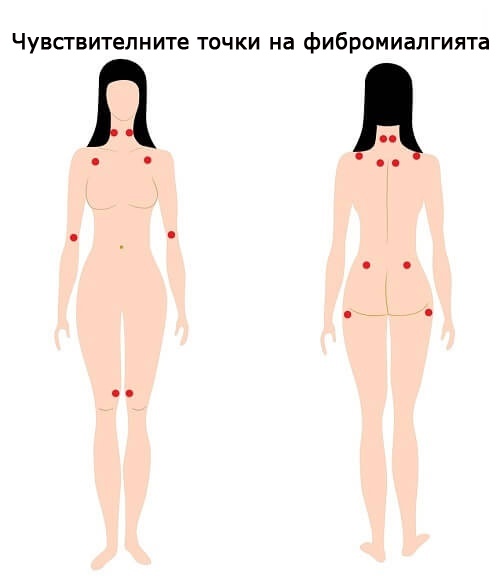 Облекчете симптомите на фибромиалгията с природни средства