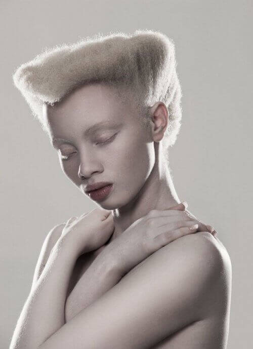 Тандо Хопа е 24-годишен модел, родена с албинизъм