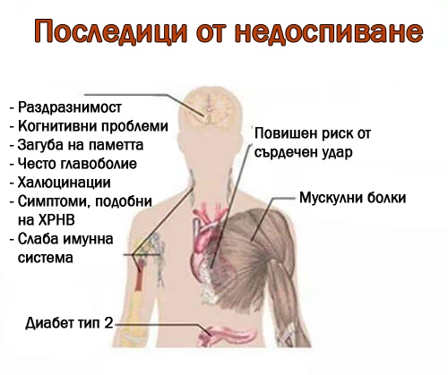 7 сериозни последици от недоспиване