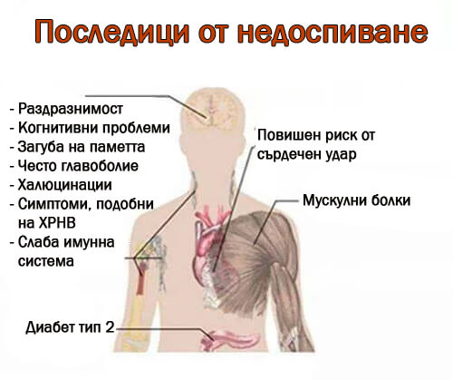 7 сериозни последици от недоспиване