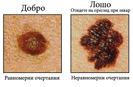 Бенки