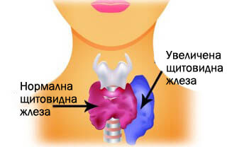 Нормална щитовидна жлеза