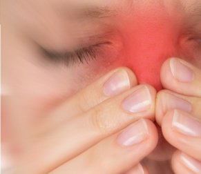 Сезонните алергии могат да са причина за синузит