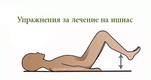 Най-добрите упражнения при възпален седалищен нерв