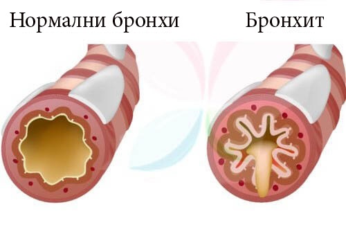 Когато детето кашля, е важно да се консултирате с лекар.