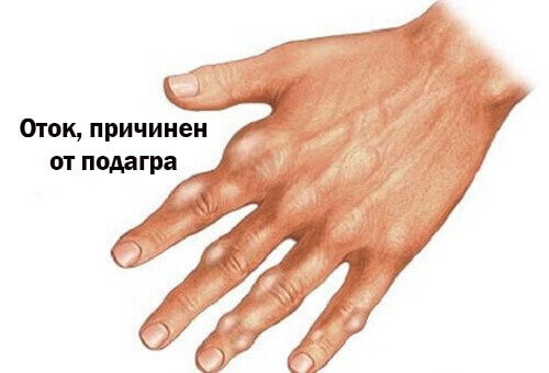 Естествено намаляване на пикочната киселина