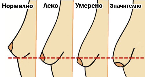 5 навика, които водят до увисване на гърдите