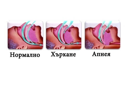 Повечето хора смятат, че мъжете хъркат повече от жените