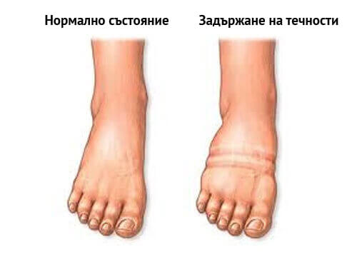 Задържане на течности? Има лек!
