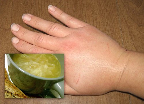30 дни, за да се справим с излишните течности