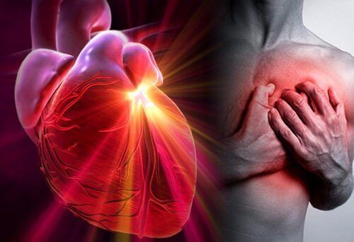Как да намалим риска от инфаркт или инсулт