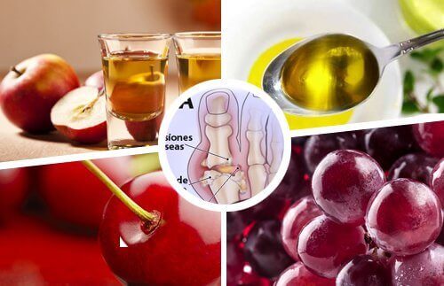 подаграта може да бъде облекчена и с натурални средства