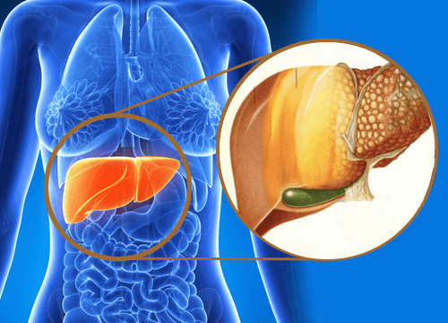 Какво представлява затлъстял черен дроб и как се лекува