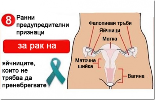 Гинекологичен рак - схема
