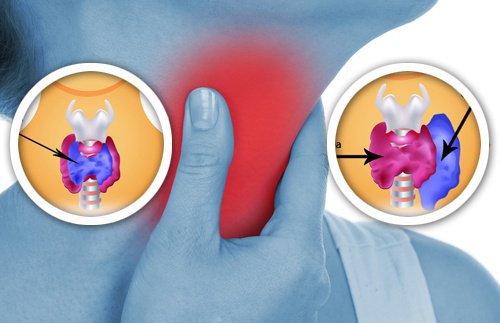 8 продукта от бита, които влияят на щитовидната жлеза