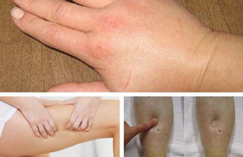 8 натурални диуретика