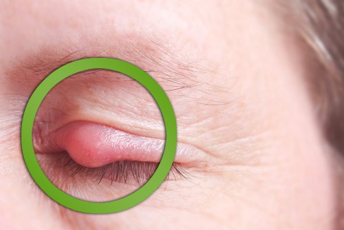 здравето на очите и ечемика