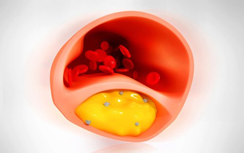 8 храни, които прочистват артериите