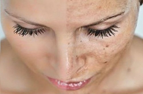 костилката на авокадото предотвратява преждевременното стареене