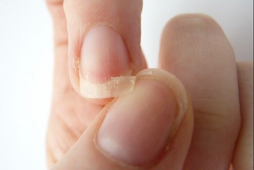 7 натурални начина за справяне с чупливите нокти