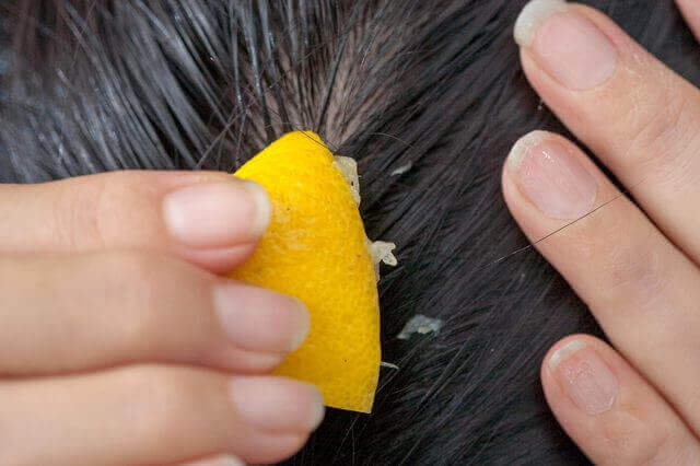 Спрете косопада с лимонов сок