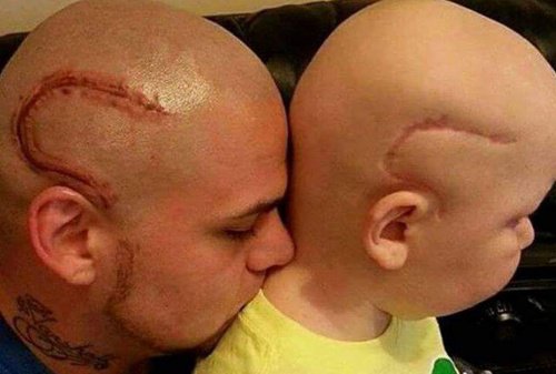 Баща прави татуировка като белега от операция на рак на сина си