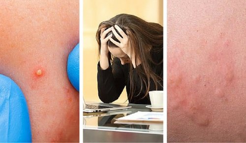 7 индикатора за високи нива на стрес