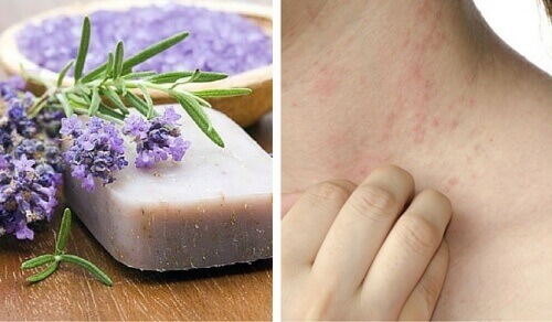 Специални домашни сапуни за чувствителна кожа и дерматит