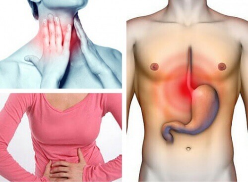 Страдате ли от стомашен рефлукс?