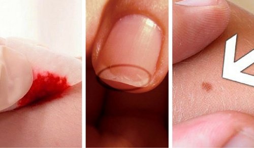 5 причини да не пропуснете прегледа при дерматолог