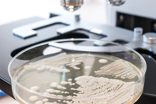 10 храни, които спират развитието на гъбичната инфекция