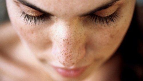 6 натурални средства срещу тъмните петна по кожата
