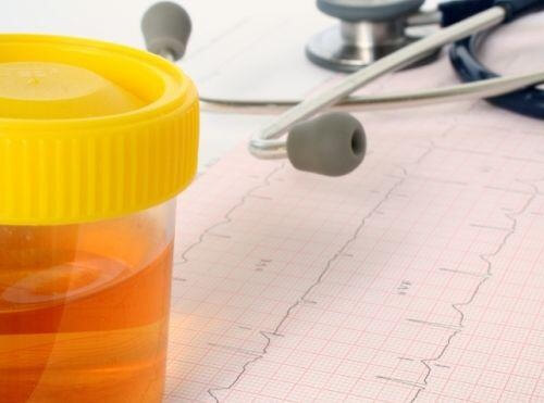 симптоми при бъбречна недостатъчност