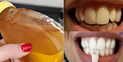 Как да избелите зъбите си със 100% натурална съставка