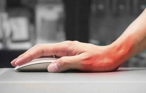 Теносиновит синдром на Де Кервен