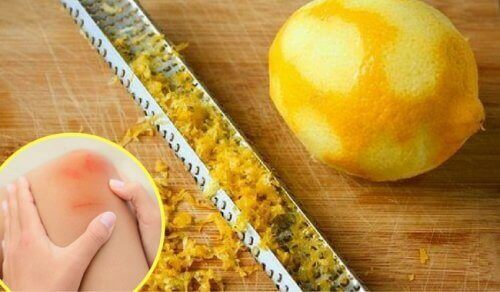 Как да използваме лимоновите кори за лечение на болки в ставите