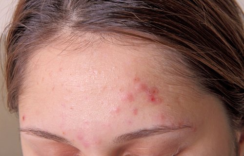 9 признака, че сте претоварени от токсини