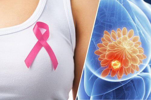 Диагностициране на рака на гърдата с едно хапче